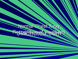 normal chest x-ray recognition of structures(学生讲课)