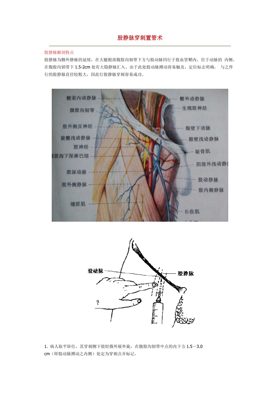 股静脉穿刺步骤图解图片