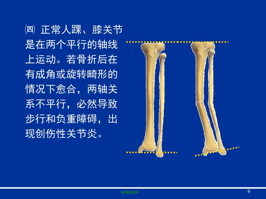 胫侧腓侧图片