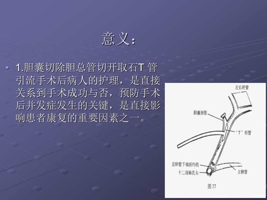 膽道術後t管的護理ppt醫學課件