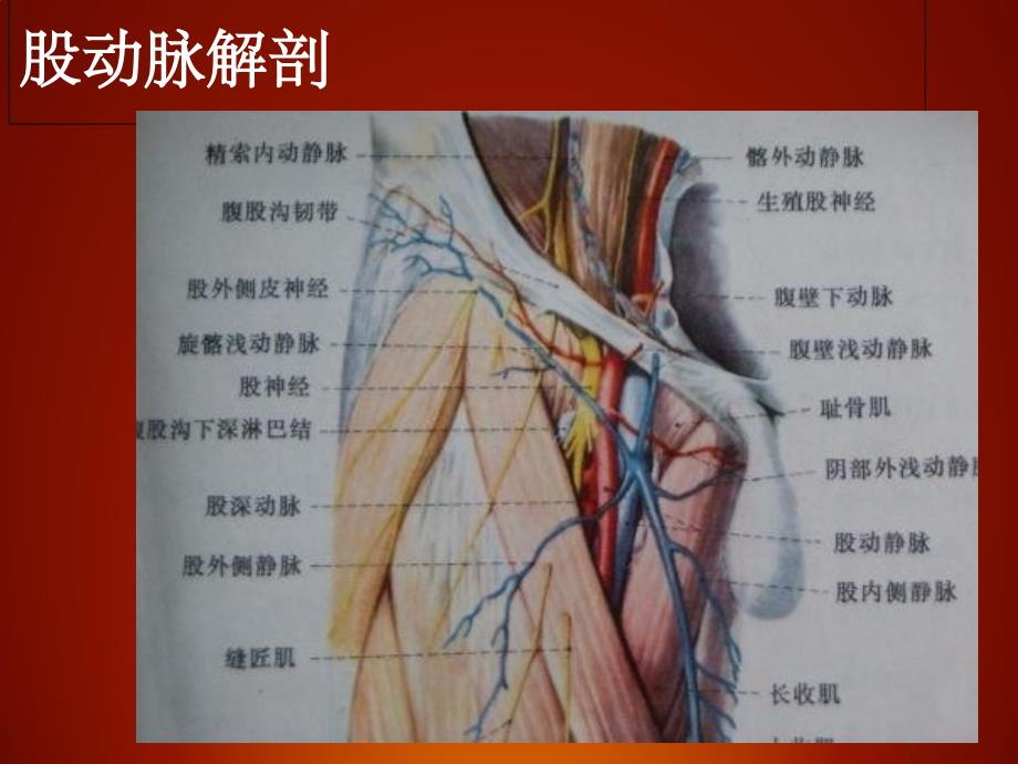 介入股动脉穿刺术ppt课件