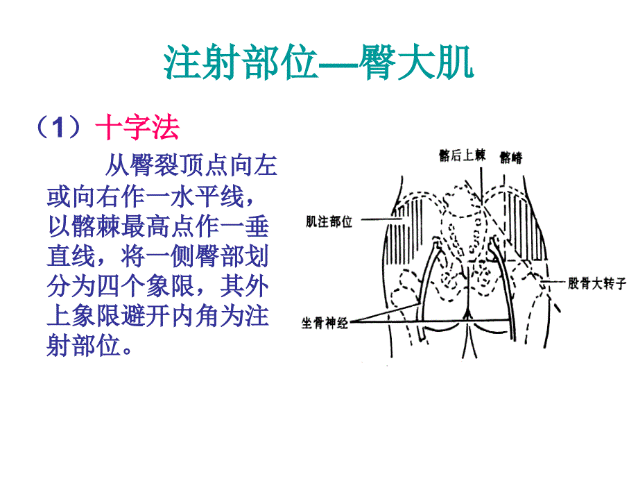 肌肉注射皮下注射ppt