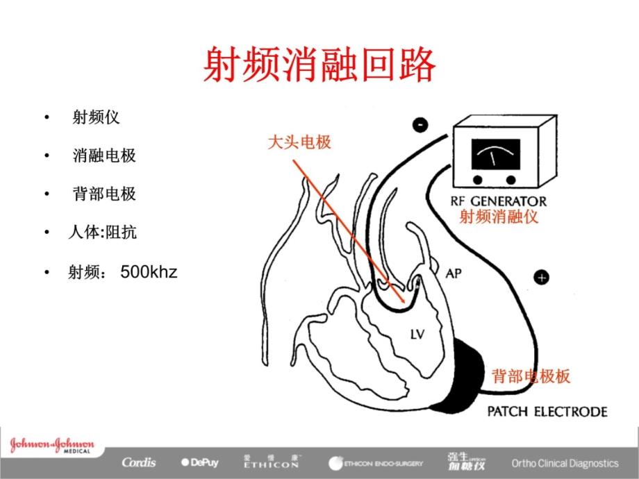 射频消融原理说课材料