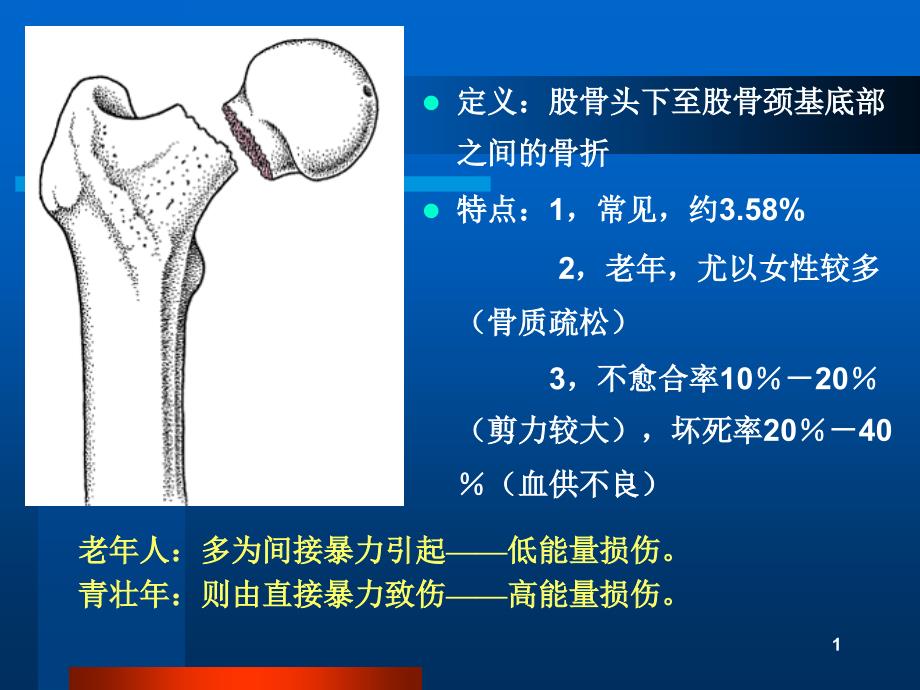 股骨頸骨折精品課件1