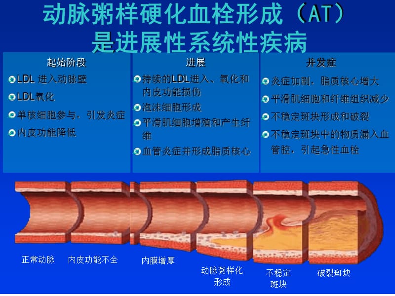 冠狀動脈粥樣硬化性心臟病預防與治療精