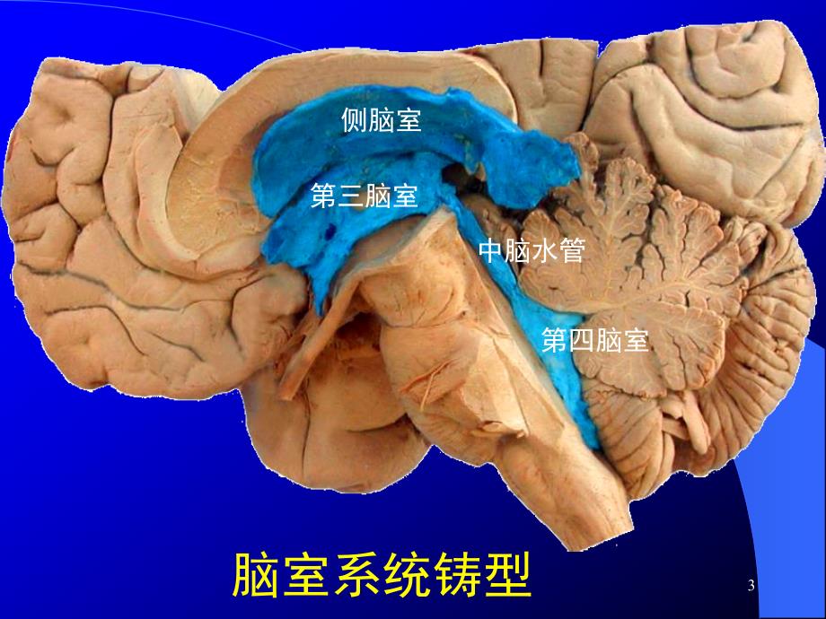 (优质医学)脑室的断层解剖
